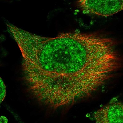 Immunocytochemistry/Immunofluorescence: RBM41 Antibody [NBP1-83788] - Staining of human cell line U-251 MG shows localization to nuclear speckles & cytosol.