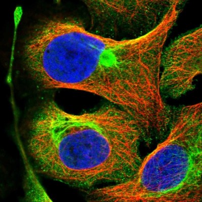 Immunocytochemistry/Immunofluorescence: FLJ21908 Antibody [NBP1-89849] - Staining of human cell line U-2 OS shows positivity in plasma membrane, cytoplasm and cytoskeleton (intermediate filaments).