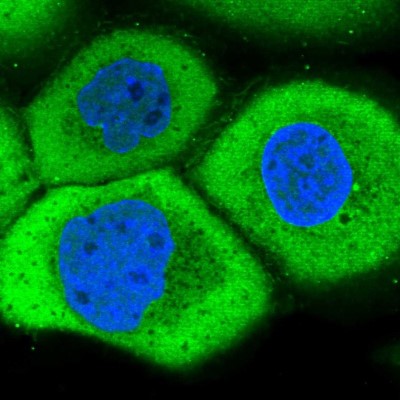 Immunocytochemistry/Immunofluorescence: LRRC45 Antibody [NBP1-93508] - Immunofluorescent staining of human cell line A-431 shows localization to plasma membrane, cytosol & centrosome.