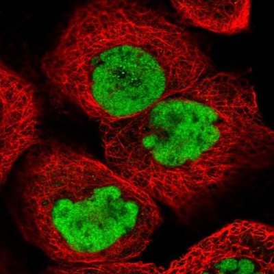 Immunocytochemistry/Immunofluorescence: SCC112 Antibody [NBP2-38313] - Immunofluorescent staining of human cell line A-431 shows localization to nucleoplasm.