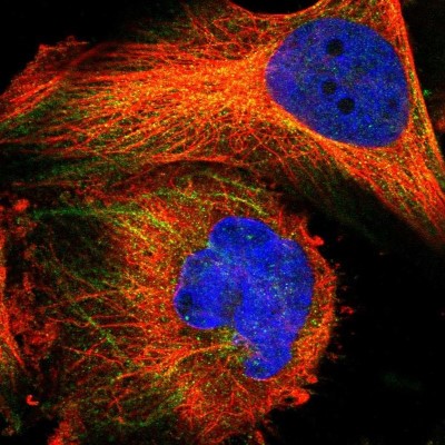 Immunocytochemistry/Immunofluorescence: FAM26E Antibody [NBP1-91162] - Staining of human cell line U-251 MG shows positivity in cytoplasm and cytoskeleton (intermediate filaments).