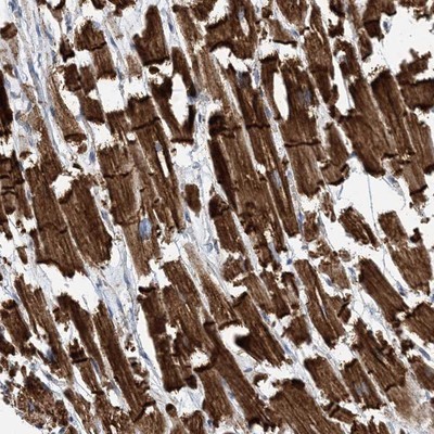 Immunocytochemistry/Immunofluorescence: FAM26E Antibody [NBP1-91162] - Staining of human heart muscle shows strong cytoplasmic and membranous positivity in myocytes.