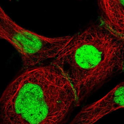 Immunocytochemistry/Immunofluorescence: RAP30 Antibody [NBP1-90812] - Immunofluorescent staining of human cell line A-431 shows localization to nucleus & cell junctions.