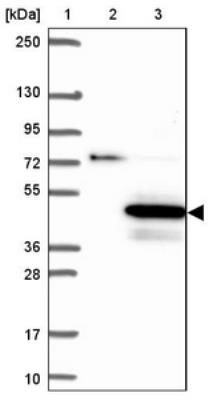 Western Blot: C16orf93 Antibody [NBP2-30829] - Lane 1: Marker [kDa] 250, 130, 95, 72, 55, 36, 28, 17, 10. Lane 2: Negative control (vector only transfected HEK293T lysate). Lane 3: Over-expression lysate (Co-expressed with a C-terminal myc-DDK tag (3.1 kDa) in mammalian HEK293T cells).