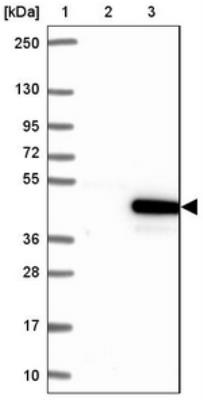 Western Blot: C16orf93 Antibody [NBP2-30950] - Lane 1: Marker [kDa] 250, 130, 95, 72, 55, 36, 28, 17, 10. Lane 2: Negative control (vector only transfected HEK293T lysate). Lane 3: Over-expression lysate (Co-expressed with a C-terminal myc-DDK tag (3.1 kDa) in mammalian HEK293T cells).