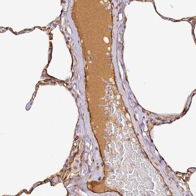 Immunohistochemistry-Paraffin: Complement Factor H-related 1/CFHR1/CFHL1 Antibody [NBP2-14474] - Staining of human lung shows distinct positivity in plasma.