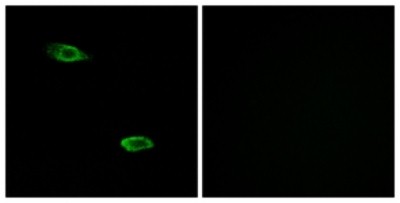 Immunocytochemistry/Immunofluorescence: PSGR Antibody [NBP1-71145] - Analysis of A549 cells, using PSGR Antibody. The picture on the right is treated with the synthesized peptide.