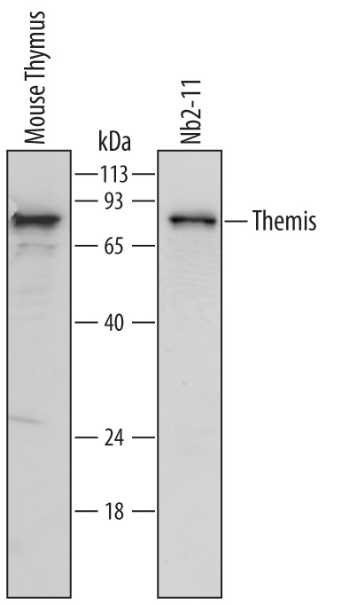 Western blot shows lysates of mouse thymus tissue and Nb2‑11 rat lymphoma cell line. PVDF Membrane was probed with 1 µg/mL of Sheep Anti-Mouse/Rat Themis Antigen Affinity-purified Polyclonal Antibody (Catalog # AF6816) followed by HRP-conjugated Anti-Sheep IgG Secondary Antibody (Catalog # HAF016). A specific band was detected for Themis at approximately 73 kDa (as indicated). This experiment was conducted under reducing conditions and using Immunoblot Buffer Group 1.