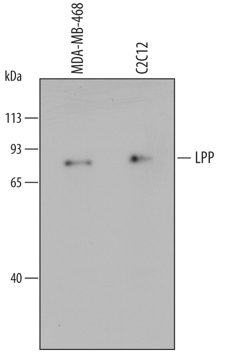 Western blot shows lysates of MDA‑MB‑468 human breast cancer cell line and C2C12 mouse myoblast cell line. PVDF membrane was probed with 0.5 µg/mL of Mouse Anti-Human LPP Monoclonal Antibody (Catalog # MAB6927) followed by HRP-conjugated Anti-Mouse IgG Secondary Antibody (Catalog # HAF007). A specific band was detected for LPP at approximately 80 kDa (as indicated). This experiment was conducted under reducing conditions and using Immunoblot Buffer Group 1.