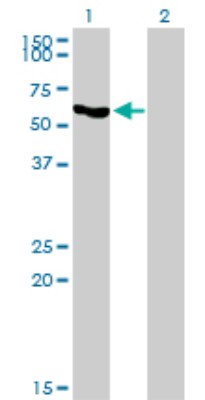 Western Blot: Acetyl-coenzyme A transporter 1 Antibody (3A4) [H00009197-M07] - Analysis of SLC33A1 expression in transfected 293T cell line by SLC33A1 monoclonal antibody (M07), clone 3A4. Lane 1: SLC33A1 transfected lysatE (60.9 KDa). Lane 2: Non-transfected lysate.