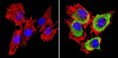 Immunocytochemistry/Immunofluorescence: SREBP1 Antibody [NB100-74542] - Analysis of SREBP1 (green) showing staining in the cytoplasm of C2C12 cells (right) compared to a negative control without primary antibody (left).