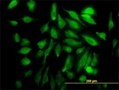Immunocytochemistry/Immunofluorescence: SH3D19 Antibody (5C7) [H00152503-M01] - Analysis of monoclonal antibody to SH3D19 on HeLa cell. Antibody concentration 10 ug/ml.