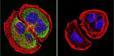 Immunocytochemistry/Immunofluorescence: PRC1 Antibody (16F2) [NB100-74508] - Analysis of PRC1 using PRC1 Monoclonal Antibody (16F2) shows staining in U251 Cells. PRC1 (green), F-Actin staining with Phalloidin (red) and nuclei with DAPI (blue) is shown. Cells were grown on chamber slides and fixed with formaldehyde prior to staining. Cells were probed without (control) or with an antibody recognizing PRC1 at a dilution of 1:20 over night at 4C, washed with PBS and incubated with a DyLight-488 conjugated.