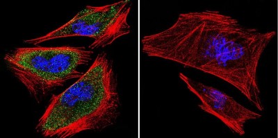 Immunocytochemistry/Immunofluorescence: PRC1 Antibody (16F2) [NB100-74508] - Analysis of PRC1 using PRC1 Monoclonal Antibody (16F2) shows staining in A2058 Cells. PRC1 (green), F-Actin staining with Phalloidin (red) and nuclei with DAPI (blue) is shown. Cells were grown on chamber slides and fixed with formaldehyde prior to staining. Cells were probed without (control) or with an antibody recognizing PRC1 at a dilution of 1:100 over night at 4C, washed with PBS and incubated with a DyLight-488 conjugated.