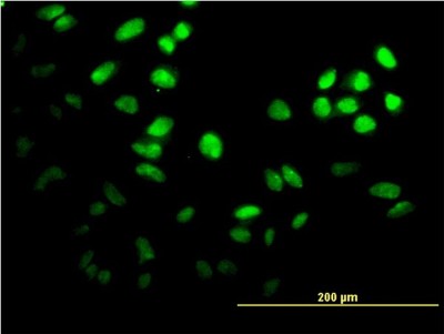 Immunocytochemistry/Immunofluorescence: FoxF2 Antibody (2G10) [H00002295-M04] - Analysis of monoclonal antibody to FOXF2 on HeLa cell. Antibody concentration 10 ug/ml
