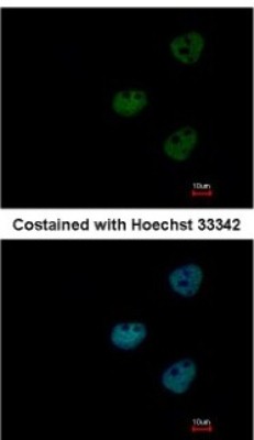 Immunocytochemistry/Immunofluorescence: CRM1 Antibody [NBP2-16014] - Analysis of paraformaldehyde-fixed HeLa, using antibody at 1:500 dilution.