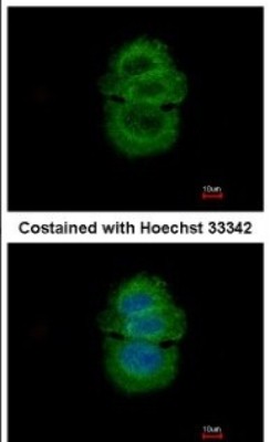 Immunocytochemistry/Immunofluorescence: Alpha-TTP Antibody [NBP2-14870] - Analysis of methanol-fixed MCF-7, using antibody at 1:500 dilution.
