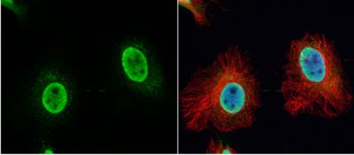 Immunocytochemistry/Immunofluorescence: VPS4B Antibody [NBP2-20881] -  HeLa cells were fixed in 4% paraformaldehyde at RT for 15 min. Green: VPS4B protein stained by VPS4B antibody [N3C3] diluted at 1:500. Red: alpha Tubulin, a cytoskeleton marker, stained by alpha Tubulin antibody [B-5-1-2]  diluted at 1:10000. Blue: Hoechst 33342 staining.
