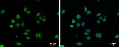 Immunocytochemistry/Immunofluorescence: VPS4B Antibody [NBP2-20881] - A375 cells were fixed in 4% paraformaldehyde at RT for 15 min. Green: VPS4B protein stained by VPS4B antibody [N3C3] diluted at 1:500. Blue: Hoechst 33342 staining. Scale bar = 10 um.