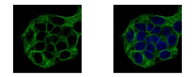 Immunocytochemistry/Immunofluorescence: Vinexin Antibody [NBP2-20861] - Sample: HepG2 cells were fixed in 4% paraformaldehyde at RT for 15 min. Green: SORBS3 protein stained by Vinexin antibody, Internal diluted at 1:500. Blue: Hoechst 33343 staining.