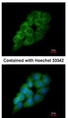 Immunocytochemistry/Immunofluorescence: DARS Antibody [NBP1-33689] - Analysis of methanol-fixed A431, using antibody at 1:200 dilution.