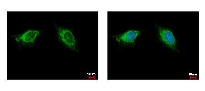 Immunocytochemistry/Immunofluorescence: NAGLU Antibody [NBP2-19465] - Sample: HeLa cells were fixed in 4% paraformaldehyde at RT for 15 min. Green: NAGLU protein stained by NAGLU antibody, Internal diluted at 1:500. Blue: Hoechst 33343 staining.