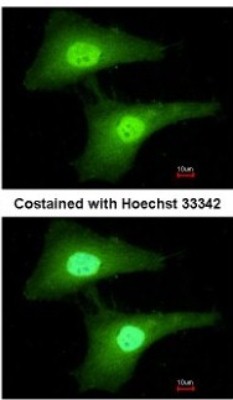 Immunocytochemistry/Immunofluorescence: STRAP Antibody [NBP2-20521] - Analysis of paraformaldehyde-fixed HeLa, using antibody at 1:200 dilution.