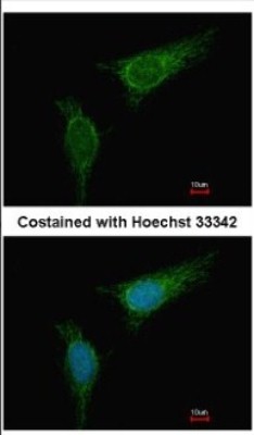 Immunocytochemistry/Immunofluorescence: BCKDHA Antibody [NBP2-15552] - Immunofluorescence analysis of methanol-fixed HeLa, using antibody at 1:500 dilution.
