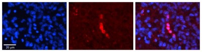 Immunocytochemistry/Immunofluorescence: ACADVL Antibody [NBP1-54378] - Formalin Fixed Paraffin; Embedded Tissue: Human Pineal Tissue; Observed Staining: Cytoplasmic in cell bodies of pinealocytes; Primary Antibody Concentration: 1:100