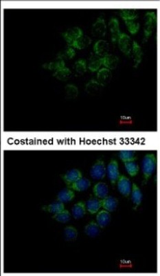 Immunocytochemistry/Immunofluorescence: FAM20C Antibody [NBP2-16415] - Immunofluorescence analysis of methanol-fixed Hep3B, using antibody at 1:200 dilution.