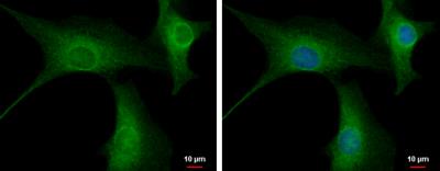 Immunocytochemistry/Immunofluorescence: PPP2R3A Antibody [NBP2-19908] - U87-MG cells were fixed in 4% paraformaldehyde at RT for 15 min. Green: PPP2R3A protein stained by PPP2R3A antibody [C2C3], C-term diluted at 1:500. Blue: Hoechst 33342 staining.