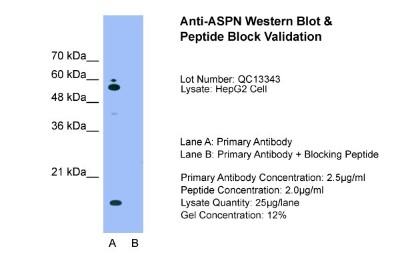 Western Blot: Asporin Antibody [NBP1-58061] - Sample Tissue: HepG2, Lane A: Primary Antibody, Lane B: Primary Antibody + Blocking Peptide, Primary Antibody Concentration: 2.5ug/mL, Peptide Concentration: 2.0ug/mL, Lysate Quantity: 25ug/lane, Gel Concentration: 12%