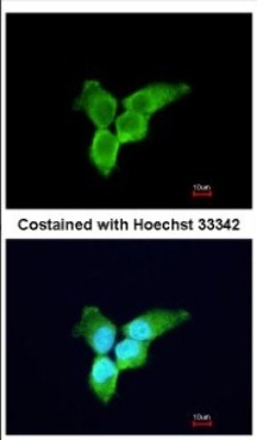 Immunocytochemistry/Immunofluorescence: ZCCHV Antibody [NBP2-20940] - Immunofluorescence analysis of paraformaldehyde-fixed A431, using antibody at 1:200 dilution.