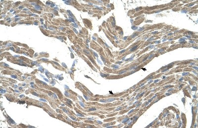 Immunohistochemistry-Paraffin: Asporin Antibody [NBP1-58061] - Human Muscle Tissue, Skeletal muscle cells (Indicated with Arrows) 4-8ug/ml.