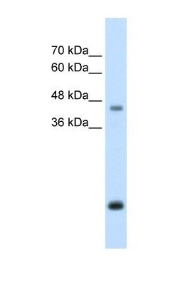 Western Blot: Asporin Antibody [NBP1-58061] - HepG2 cell lysate, Antibody Titration: 2.5ug/ml