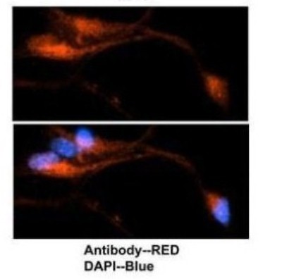 Immunocytochemistry/Immunofluorescence: TRIP1 Antibody [NBP1-98293] - Mouse brain stem cells, 2 ug/ml.