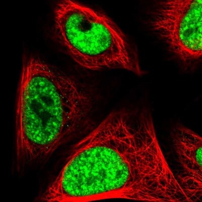 Immunocytochemistry/Immunofluorescence: CROP Antibody [NBP1-88053] - Staining of human cell line U-2 OS shows localization to nuclear speckles.