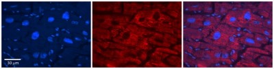 Immunohistochemistry: Acetyl-coenzyme A transporter 1 Antibody [NBP1-59882] - Formalin Fixed Paraffin Embedded Tissue: Human Adult heart Observed Staining: Cytoplasmic,Membrane Primary Antibody Concentration: 1:600 Secondary Antibody: Donkey anti-Rabbit-Cy2/3 Secondary Antibody Concentration: 1:200 Magnification: 20X Exposure Time: 0.5 - 2.0 sec Protocol located in Reviews and Data.