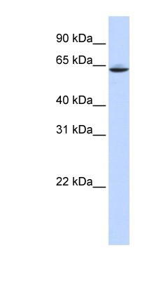 Western Blot: Acetyl-coenzyme A transporter 1 Antibody [NBP1-59882] - Human Placenta lysate, concentration 0.2-1 ug/ml.