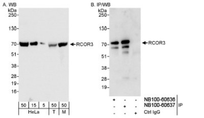 Western Blot: CoREST3/RCOR3 Antibody [NB100-60637] - Whole cell lysate from HeLa (5, 15 and 50 ug for WB; 1 mg for IP, 20% of IP loaded), 293T (T; 50 ug) and mouse NIH3T3 (M; 50 ug) cells.  NB100-60637 used for WB at 0.04 ug/ml (A) and 1 ug/ml (B) and used for IP at 3 ug/mg lysate. RCOR3 was also immunoprecipitated by rabbit anti-RCOR3 antibody NB100-60636, which recognizes an upstream epitope.