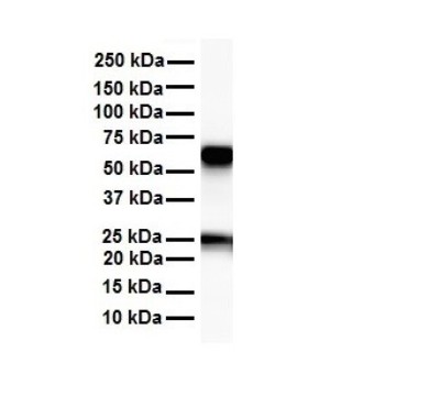 Western Blot: Acetyl-coenzyme A transporter 1 Antibody [NBP1-59882] - Antibody  Titration: 1 ug/ml Human heart.