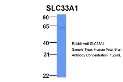 Western Blot: Acetyl-coenzyme A transporter 1 Antibody [NBP1-59882] - Sample Type: Human Fetal Brain Antibody Dilution: 1.0 ug/ml