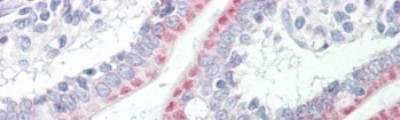 Immunohistochemistry: Acetyl-coenzyme A transporter 1 Antibody [NBP1-59882] - Human Adult Small intestine Observed Staining: Cytoplasm in hepatocytes Primary Antibody Concentration: 1 : 600 Secondary Antibody: Donkey anti-Rabbit-Cy3 Secondary Antibody Concentration: 1 : 200 Magnification: 20X Exposure Time: 0.5 2.0 sec.