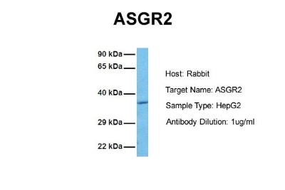 Western Blot: Asialoglycoprotein Receptor 2 Antibody [NBP1-54888] - Sample Tissue: Human HepG2 Antibody Dilution: 1.0 ug/ml