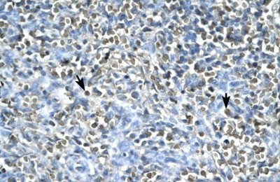 Immunohistochemistry: Asialoglycoprotein Receptor 2 Antibody [NBP1-54888] - Human Spleen