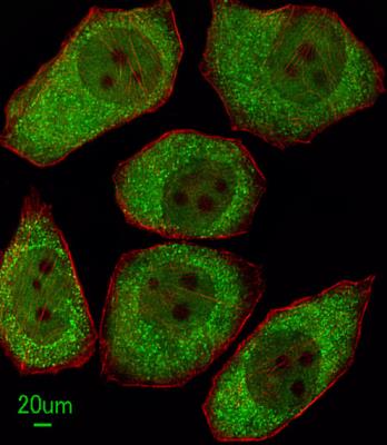 Immunocytochemistry/Immunofluorescence: 12-Lipoxygenase Antibody [NBP2-29941] - Immunofluorescent analysis of A549 cells, using ALOX12 Antibody (C-term) (NBP2-29941). NBP2-29941 was diluted at 1100 dilution. Alexa Fluor 488-conjugated goat anti-rabbit lgG at 1:400 dilution was used as the secondary antibody (green). Cytoplasmic actin was counterstained with Dylight Fluor 554 (red) conjugated Phalloidin (red).