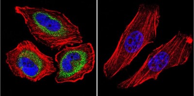 Immunocytochemistry/Immunofluorescence: CNG1 Antibody (CNC 9C1) [NB100-74389] - CNG Channel staining (green), F-Actin staining with Phalloidin (red) and nuclei with DAPI (blue) is shown. Cells were grown on chamber slides and fixed with formaldehyde prior to staining. Cells were probed without (control) or with or an antibody recognizing CNG Channel at a dilution of 1:20 over night at 4C, washed with PBS and incubated with a DyLight-488 conjugated.