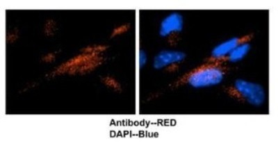 Immunocytochemistry/Immunofluorescence: UBE2N/Ubc13 Antibody [NBP1-54894] - Mouse brain stem cells, 2 ug/ml.