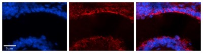 Immunocytochemistry/Immunofluorescence: MICALL1 Antibody [NBP1-79460] - Formalin Fixed Paraffin Embedded Tissue: Human Bronchial Epithelial Tissue  Observed Staining: Cytoplasmic