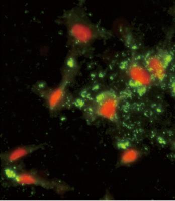 Immunocytochemistry/Immunofluorescence: ARPC1A Antibody [NBP2-30069] - Immunofluorescence analysis of (C-term) with hela cells. 0.025 mg/ml primary antibody was followed by FITC-conjugated goat anti-rabbit lgG (whole molecule). FITC emits green fluorescence.Red counterstaining is PI.